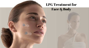 What is LPG? All about Facial and Body LPG Treatment Before and After