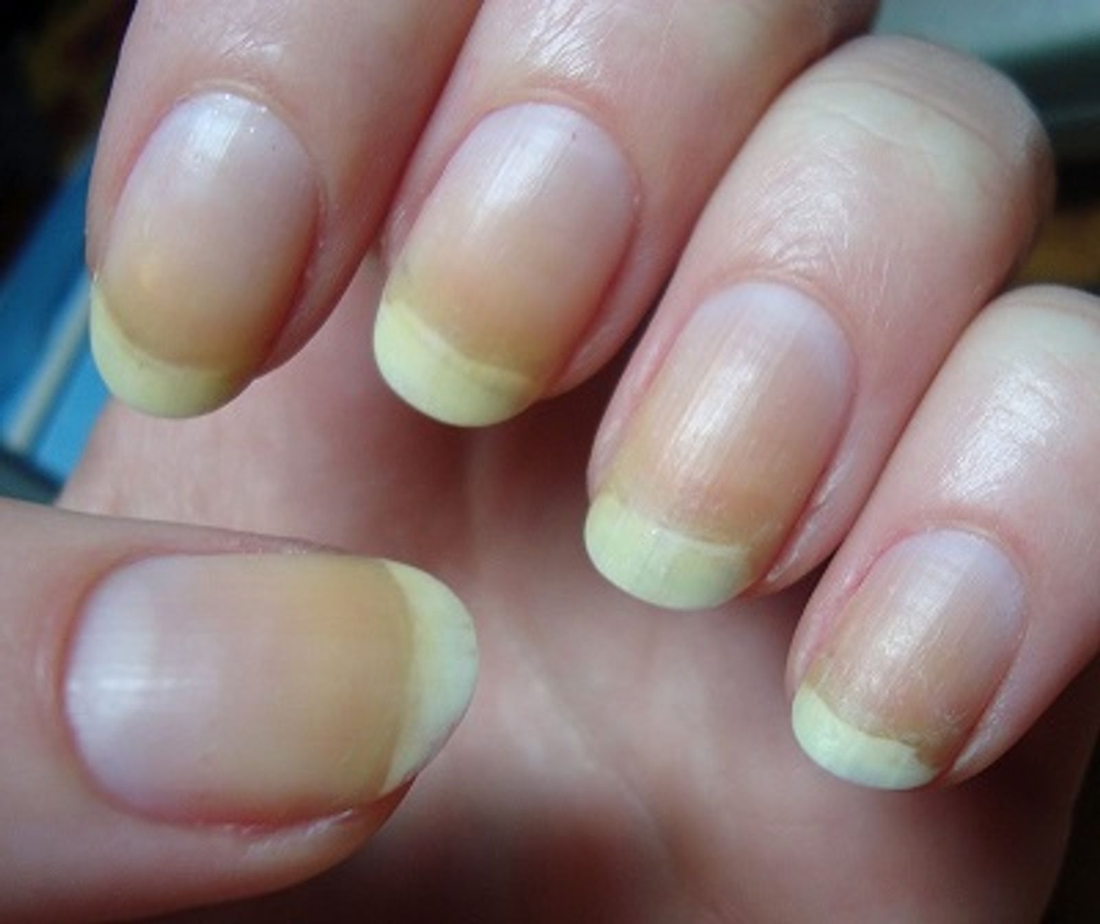Tips for Beautiful Nails