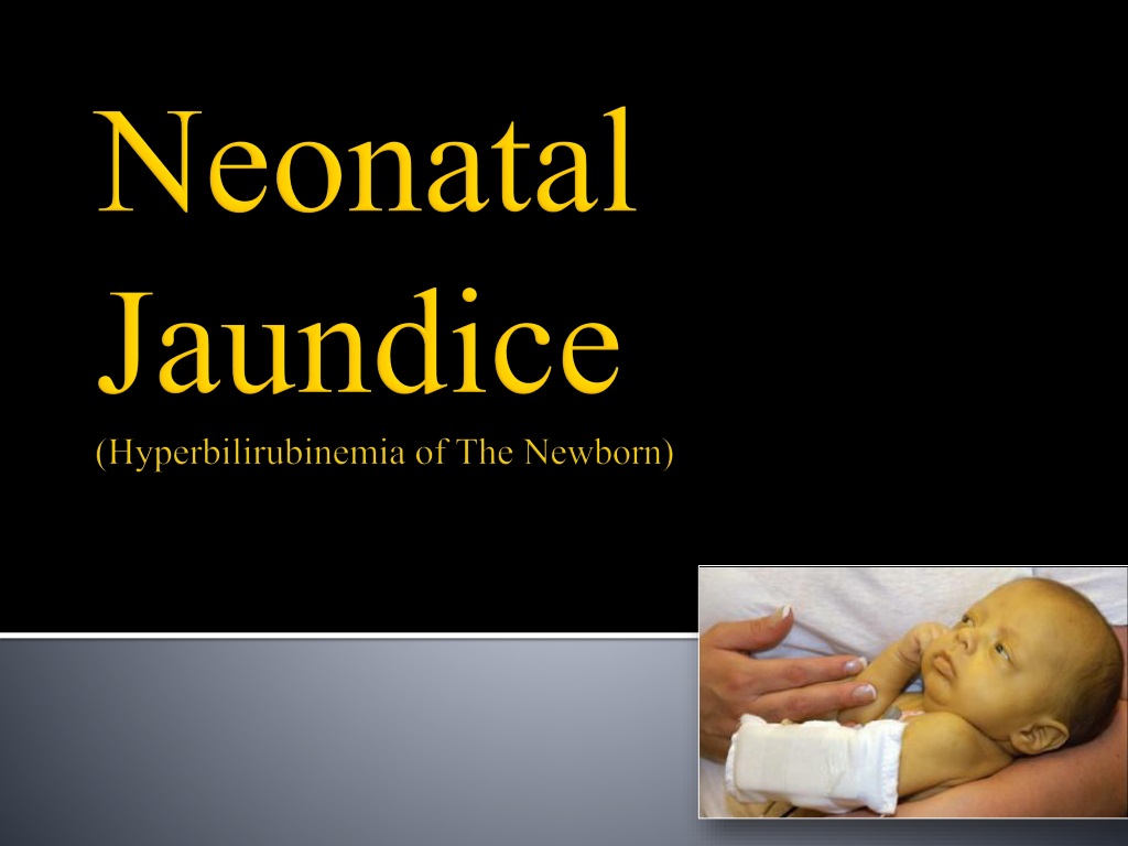 Neonatal Jaundice Causes, Symptoms, Treatment
